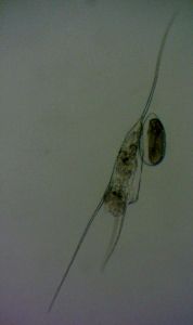 07. Rädertier - Kellicottia longispina.jpg